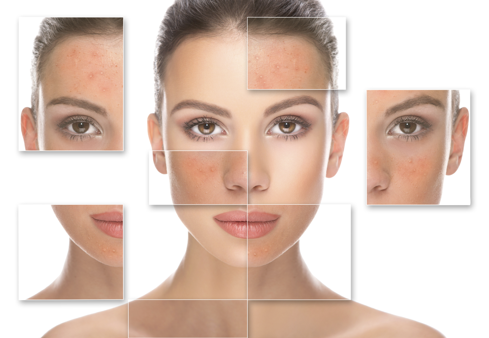 Enjoy renewed softness through balanced treatment targeting uneven tone and improving smooth surface appearance